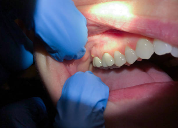 Best Cosmetic Emergency Dentistry in Frontenac, MO