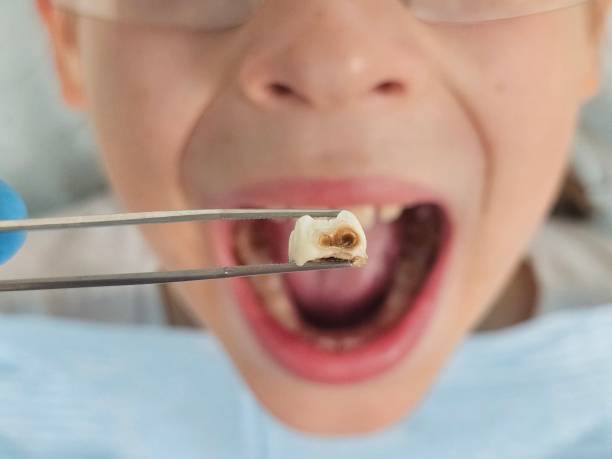 Best Pediatric Emergency Dentist in Frontenac, MO